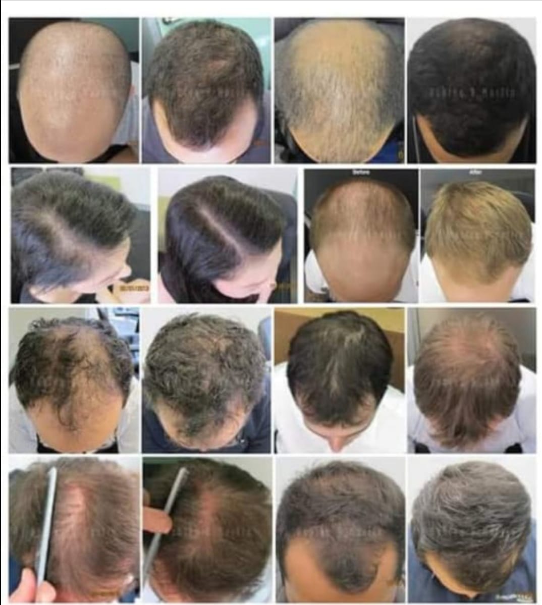 ADIVASI KARNATAKA HAKKI PIKKI HAIR OIL